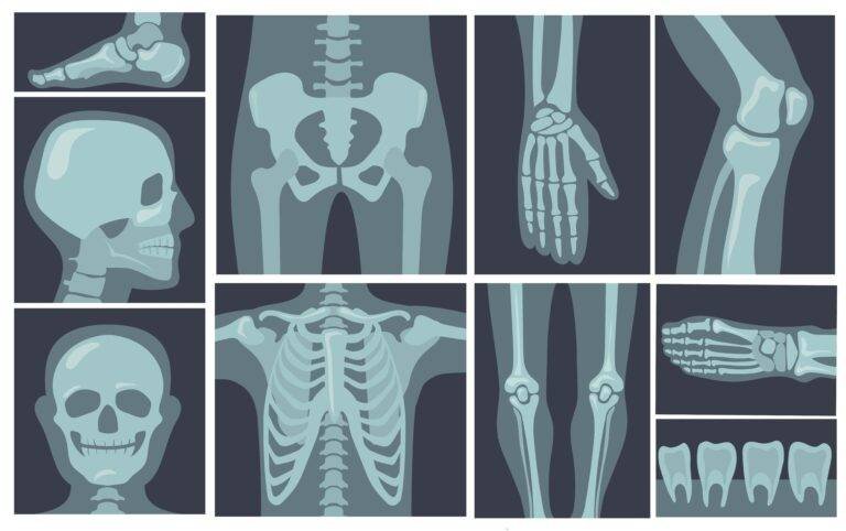 Orthopedics and Traumatology